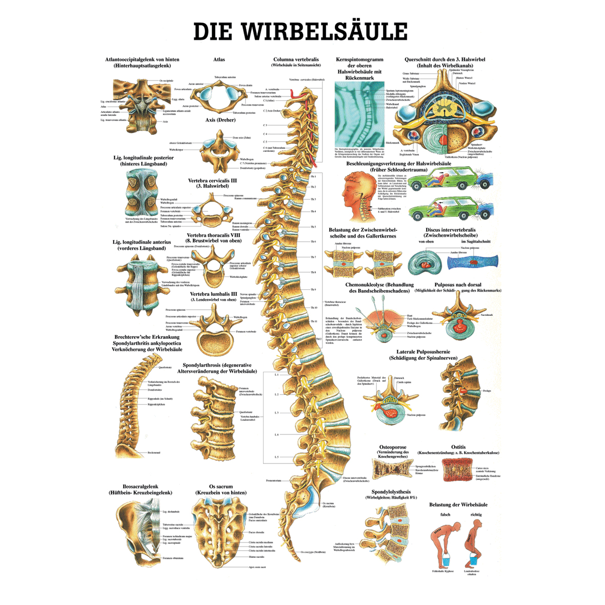 Anatomische Lehrtafel "Die Wirbelsäule"